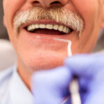 Types of dentures