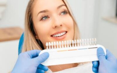 Dental Veneers in Tijuana